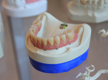 dentures on white scale rack